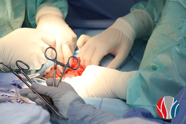 Cirurgia Endovascular